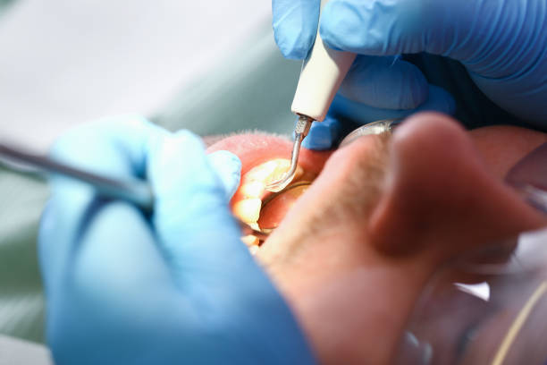 Best Urgent Care for Lost Fillings or Crowns in Coldwater, MS