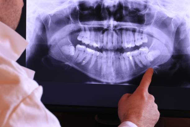 Best Same-Day Emergency Dental Services in Coldwater, MS