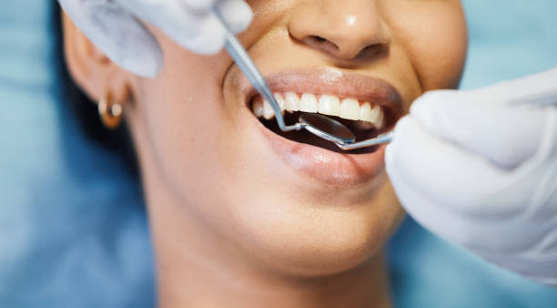 Best Emergency Treatment for Dental Infections or Abscesses in Coldwater, MS